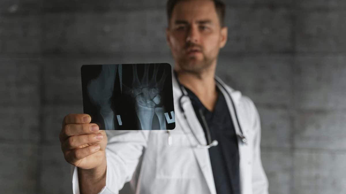 A male doctor in a lab coat holding and examining an X-ray image in a clinical setting.