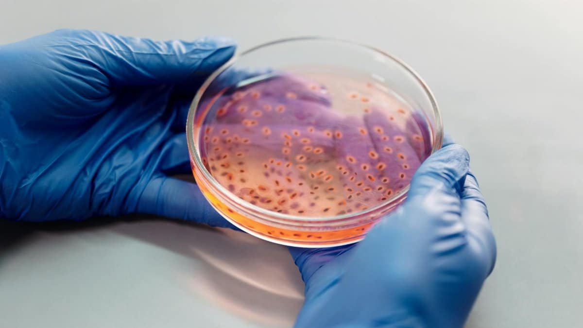 Scientist's hands with gloves examining bacterial culture in a petri dish for laboratory research.