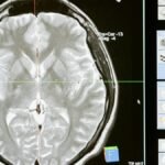 Intricate MRI brain scan displayed on a computer screen for medical analysis and diagnosis.