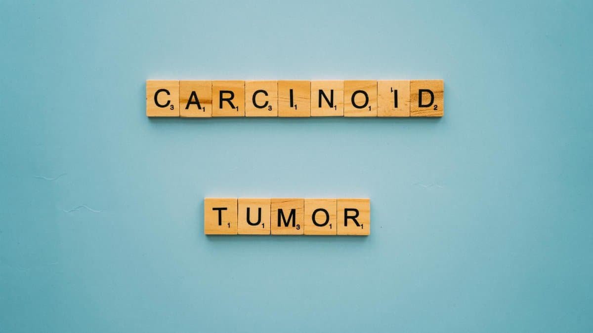 Scrabble tiles spelling 'Carcinoid Tumor' on blue background, symbolizing health awareness.