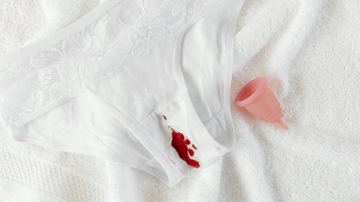A menstrual cup alongside stained underwear on a clean towel, symbolizing menstrual health.