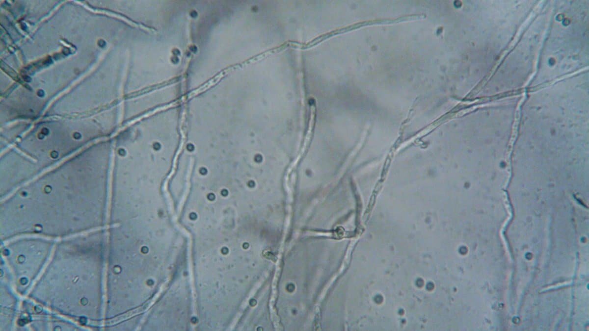 Close-up image of fungal hyphae and spores under a microscope, showcasing microbiological structures.