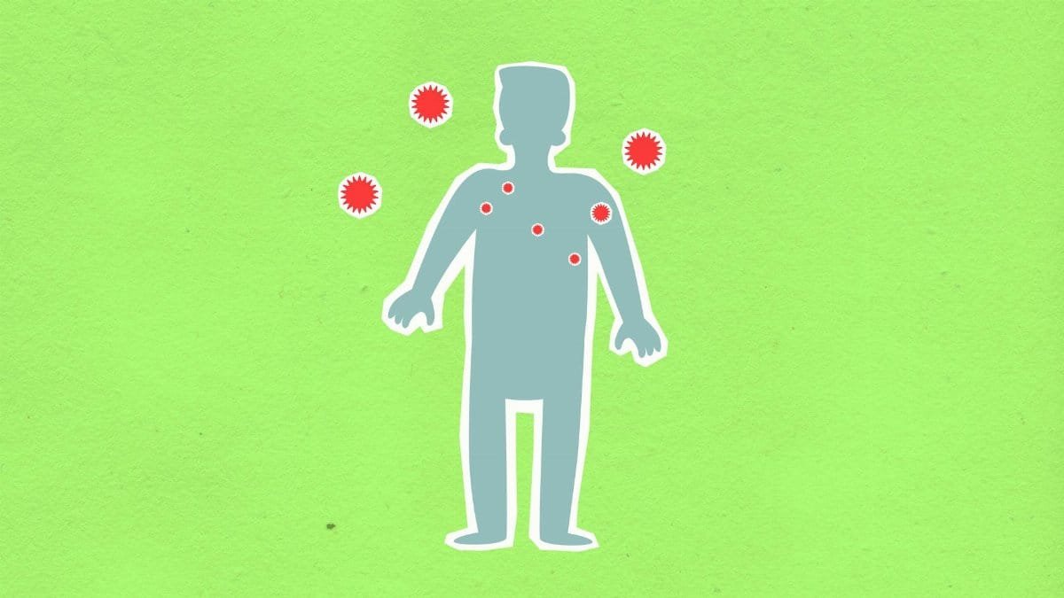 Conceptual illustration depicting viral infection symptoms on a human silhouette.