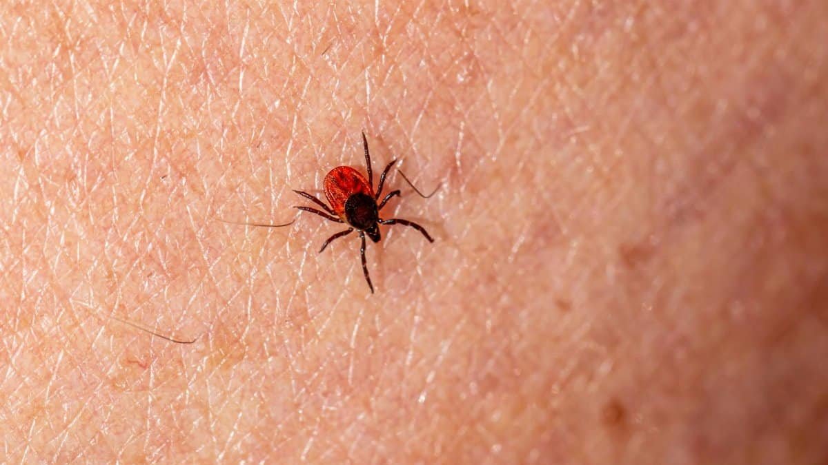Macro photograph showing a deer tick (Ixodes scapularis) on human skin, highlighting pest detail.