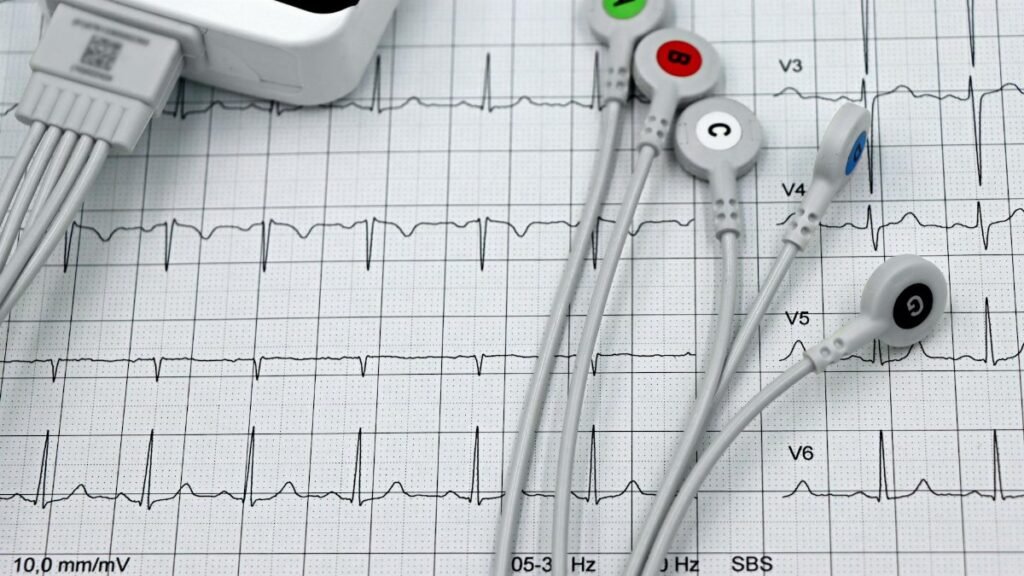 Close-up of ECG monitor leads on a printed cardiogram, showcasing heart health diagnostics.