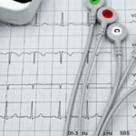 Close-up of ECG monitor leads on a printed cardiogram, showcasing heart health diagnostics.
