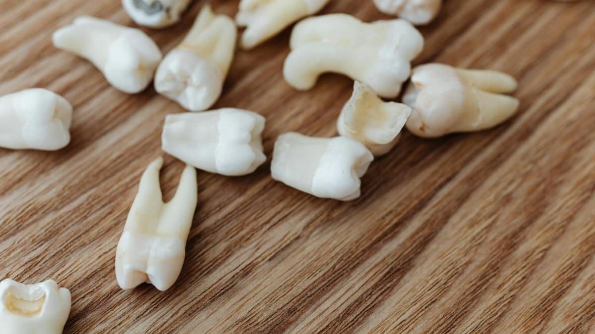 A detailed close-up of multiple extracted human teeth arranged on a wooden background surface.