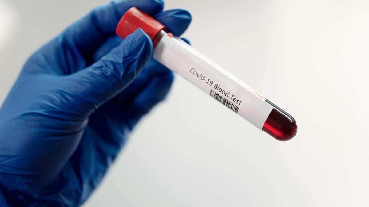 Medical professional holding Covid-19 blood test sample in laboratory, highlighting healthcare research.