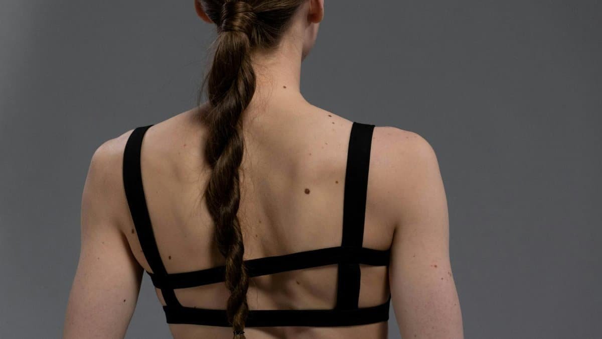 Close-up of a woman's back with braided hair and moles, wearing a black strappy top.