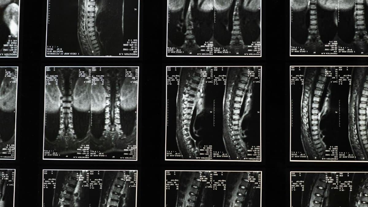 Comprehensive spinal x-ray images, ideal for medical studies and diagnostics.