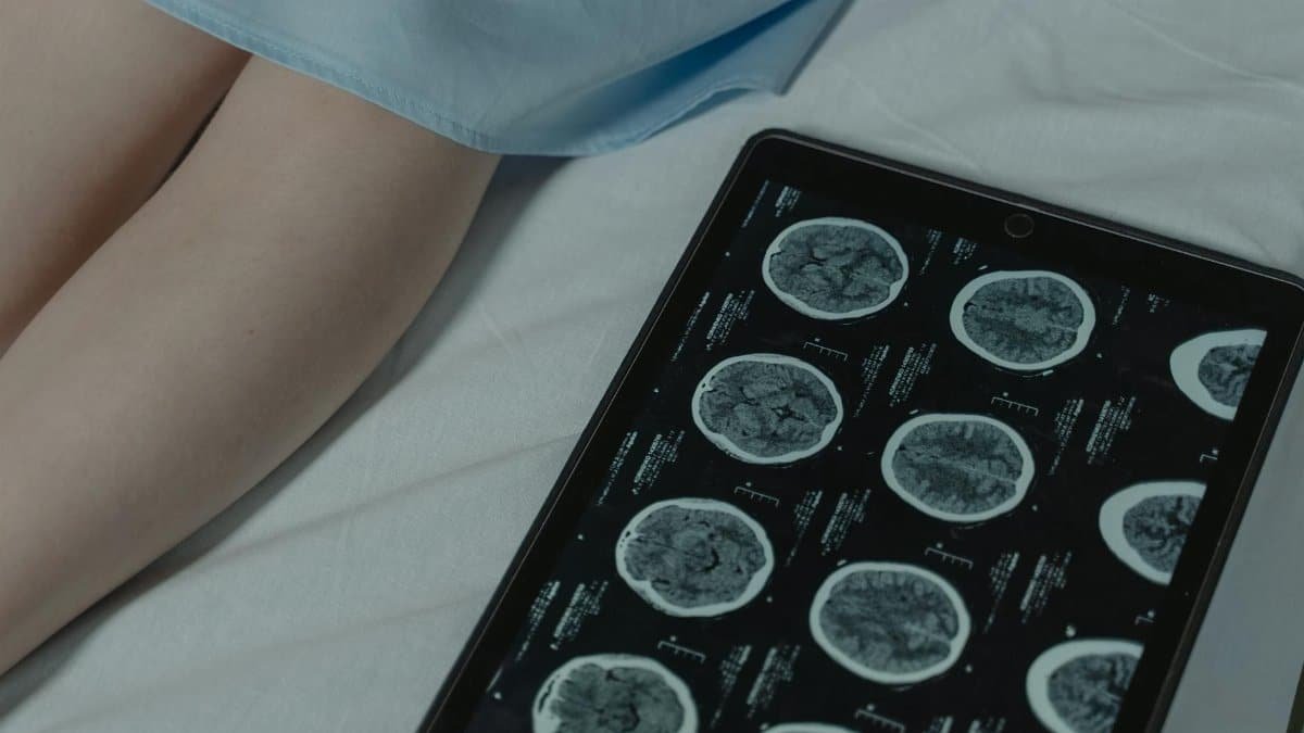 Close-up of brain CT scan display on tablet beside patient's legs in a hospital room.