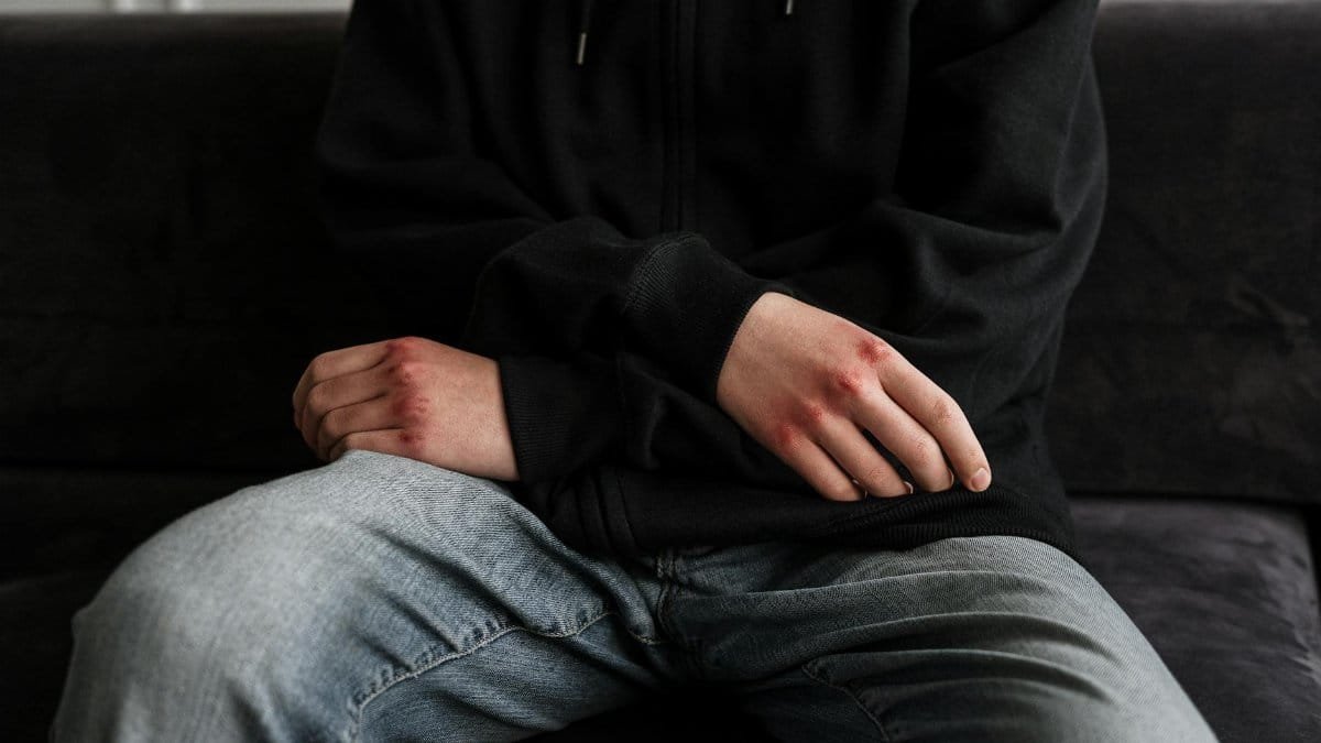 A close-up of a teenager with bruised hands, wearing a hoodie and jeans, sitting on a couch.
