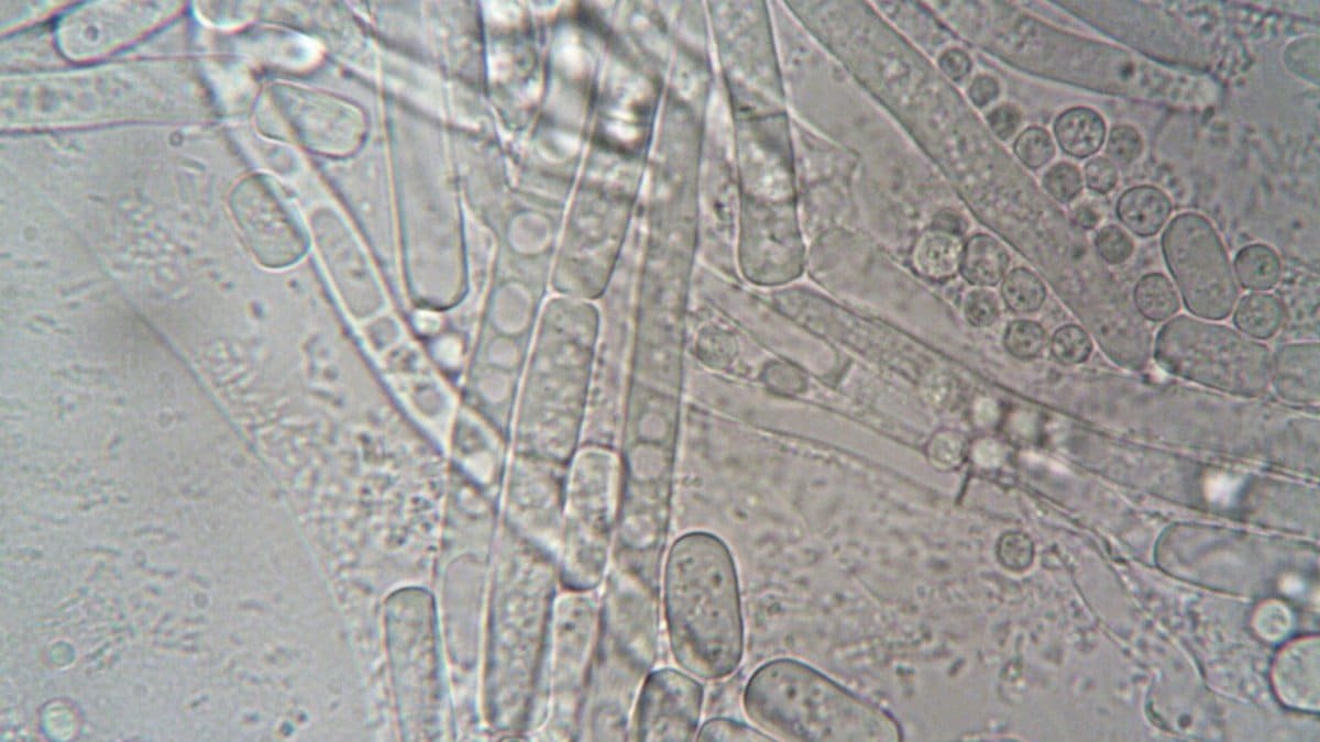 Close-up image of fungal hyphae under microscope showcasing biological structures.