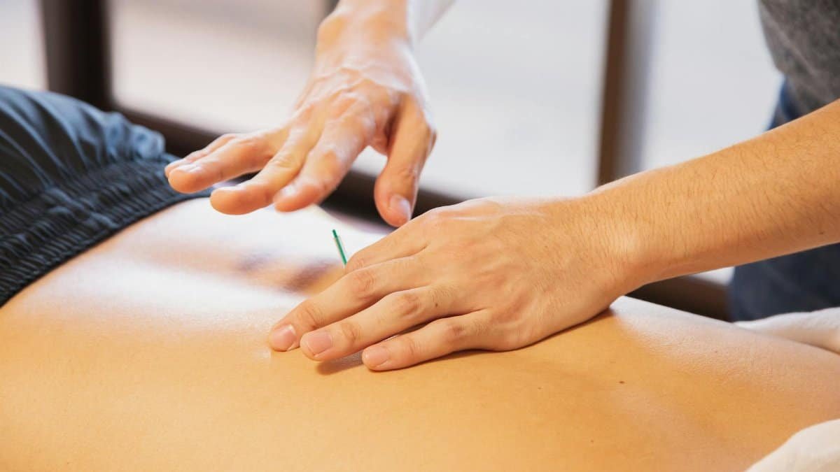 Crop anonymous male doctor putting needles on back during acupuncture therapy session in rehabilitation salon