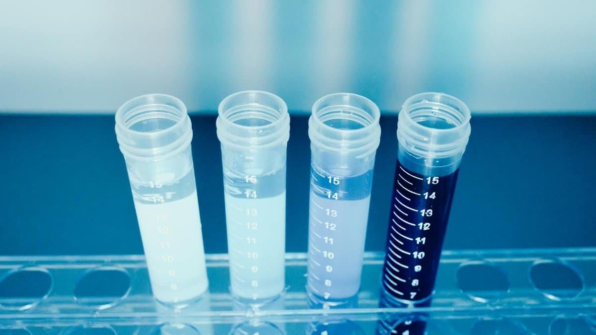 Close-up of colorful test tubes in a laboratory setting for medical and scientific research.