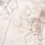 Close-up image depicting the detailed structure of fungal hyphae under a microscope.
