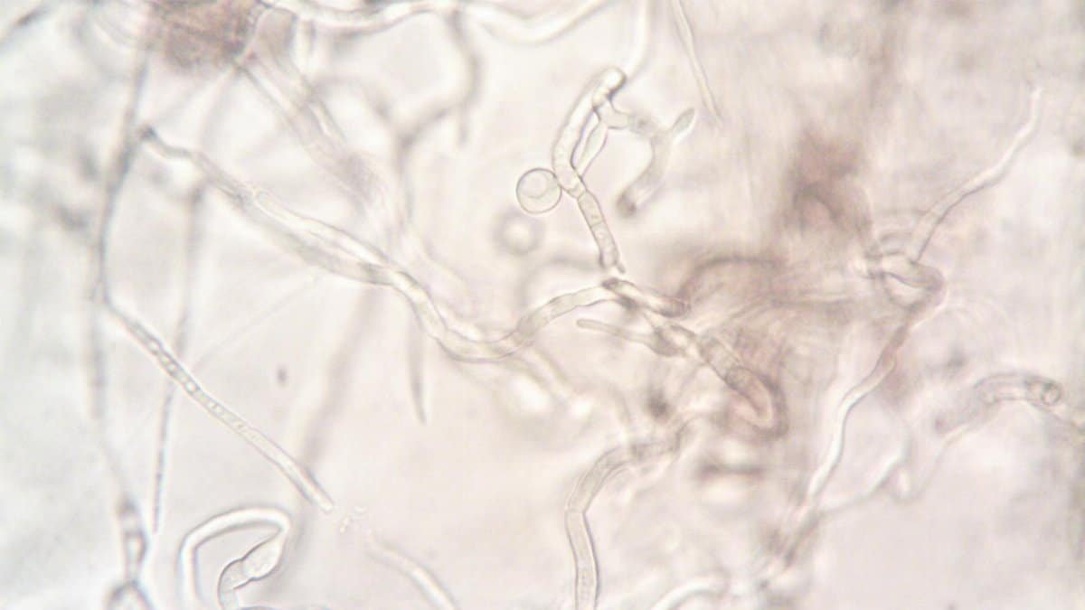Close-up image depicting the detailed structure of fungal hyphae under a microscope.
