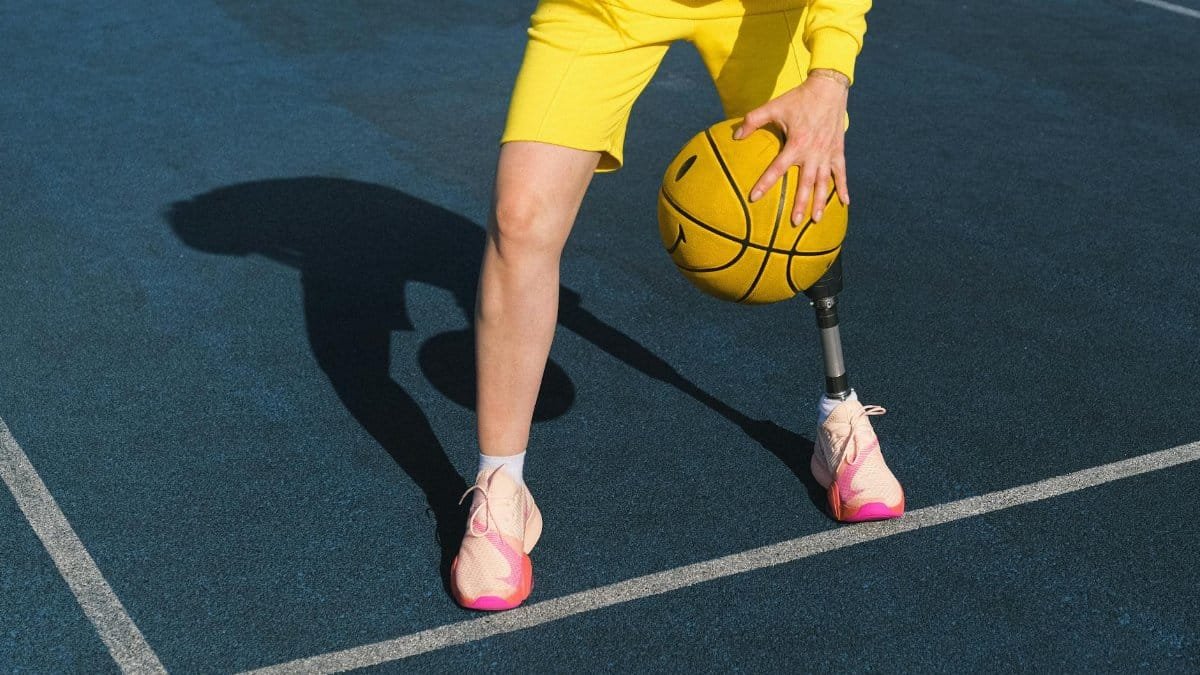 A young adult playing basketball on an outdoor court wearing sports clothing and a prosthetic leg.