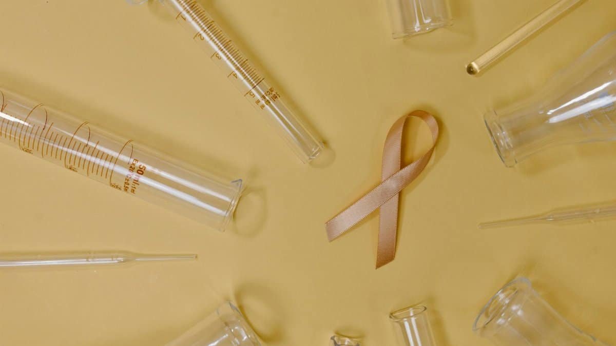 Top view of pink ribbon representing cancer placed on yellow background among glass test tubes and flasks in light studio