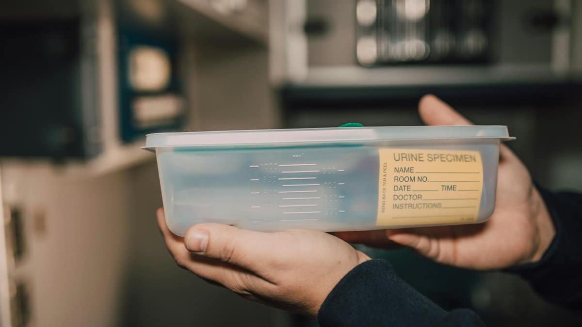 Close-up of hands holding a urine specimen container in a lab environment.