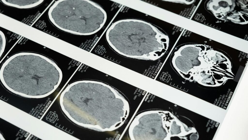 Detailed brain MRI scans displayed on a lightbox, showcasing medical imaging techniques.