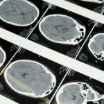 Detailed brain MRI scans displayed on a lightbox, showcasing medical imaging techniques.