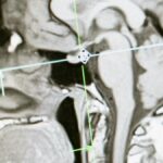 Close-up of an MRI scan showing a sagittal view of the human brain for analysis.