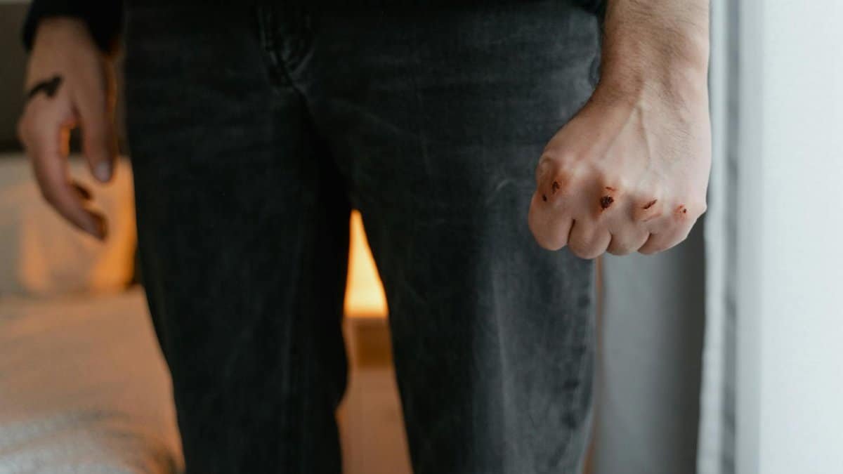A detailed view of a man's bruised fist, symbolizing aggression or injury.