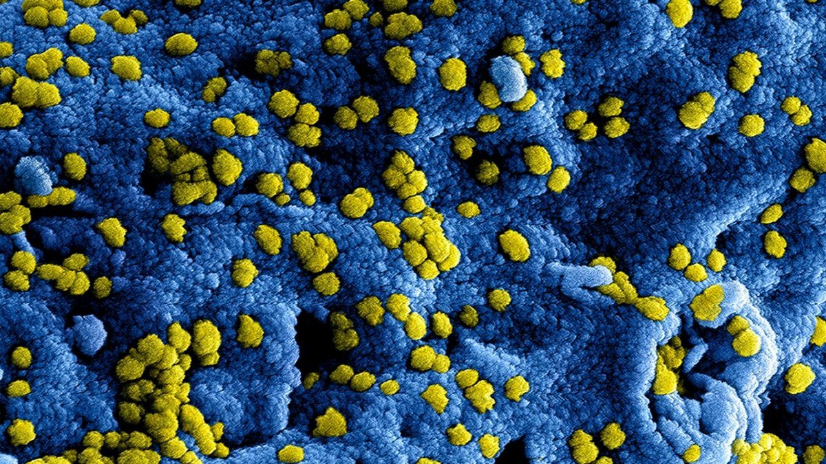 Microscopic view of yellow virus particles on a blue surface, showcasing intricate details.