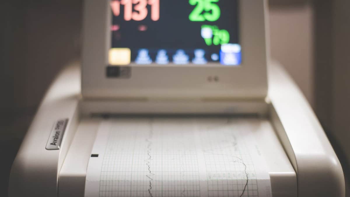 Detailed image of an electronic fetal monitoring machine showing heart rate and contraction data.
