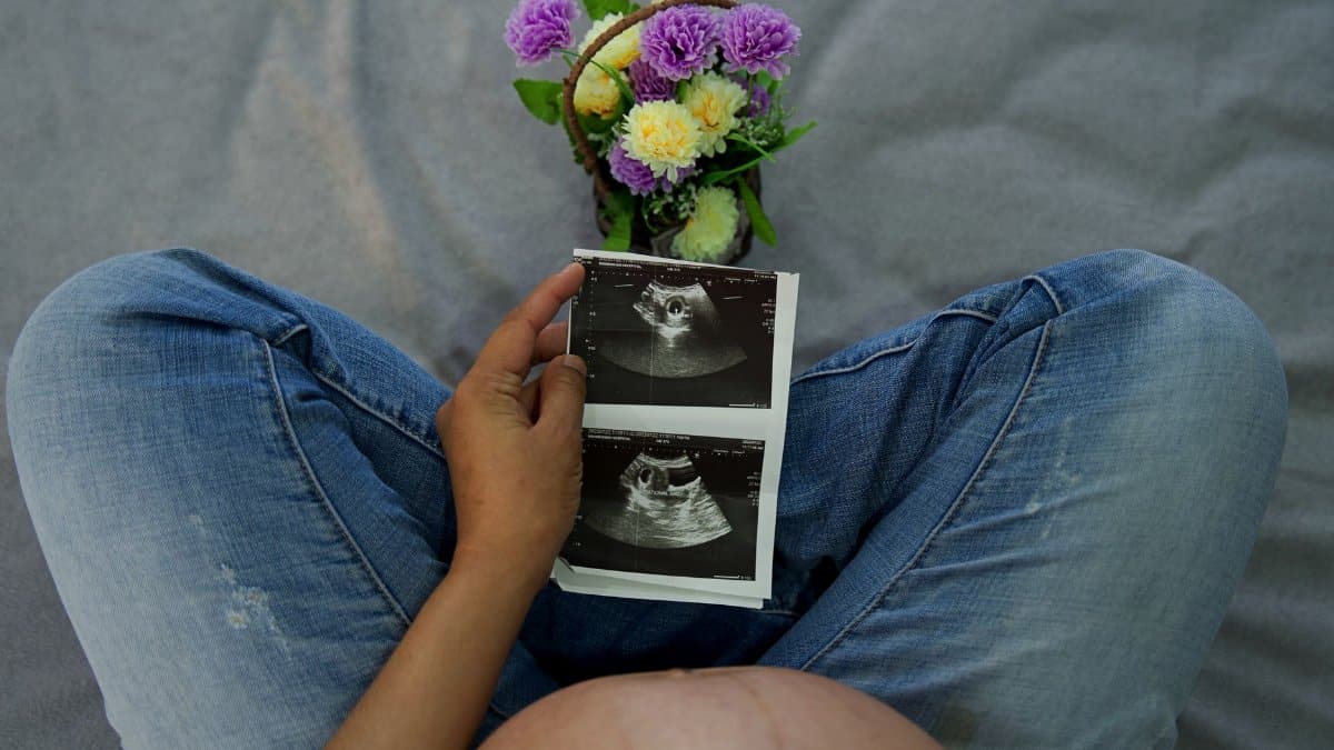 A pregnant woman holding ultrasound images with flowers, showcasing maternal joy.