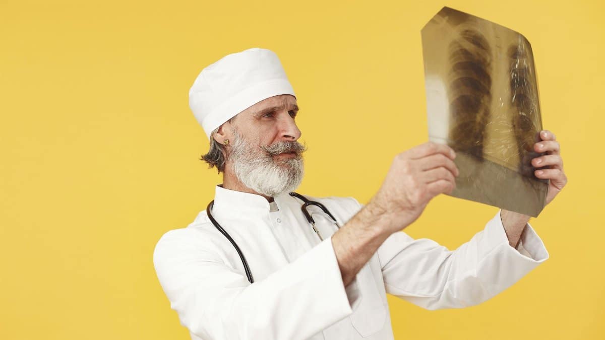 Elderly doctor in white coat examining a chest X-ray image against a bright yellow backdrop.