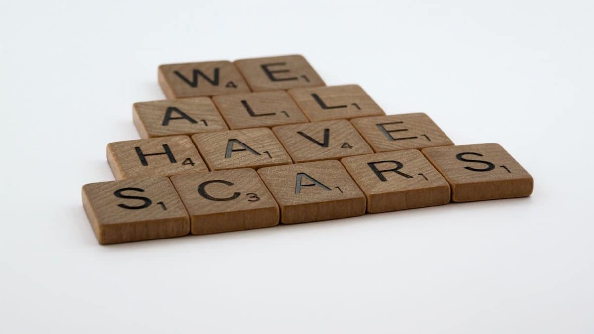 Wooden letter tiles arranged to spell 'we all have scars' on a white background.