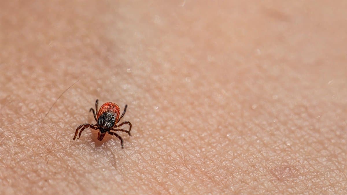 Macro image of a tick on human skin, highlighting textures and details.