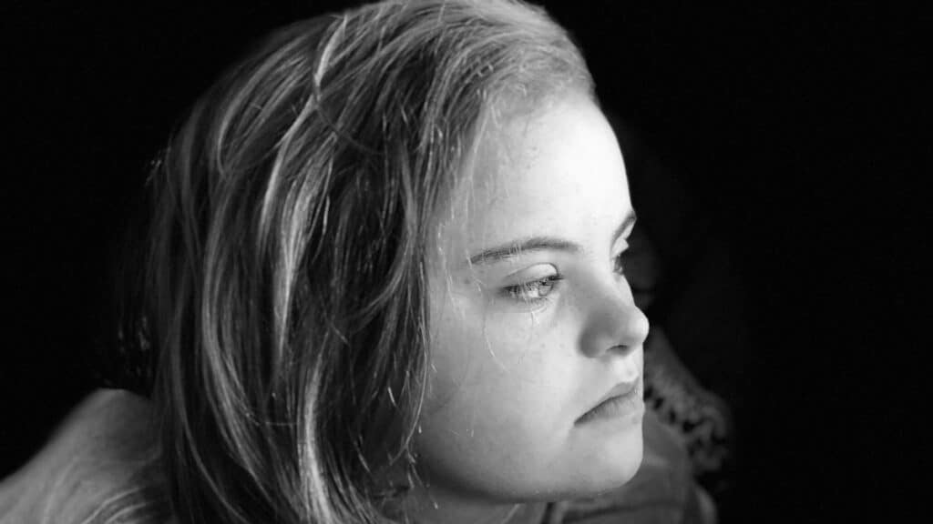 A grayscale portrait of a young caucasian girl with Down syndrome looking to the side thoughtfully.