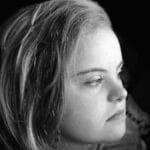 A grayscale portrait of a young caucasian girl with Down syndrome looking to the side thoughtfully.