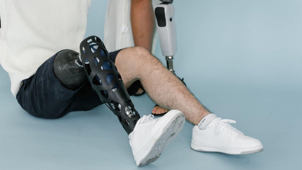 Close-up of a person wearing a bionic prosthetic leg while sitting in a studio setting.