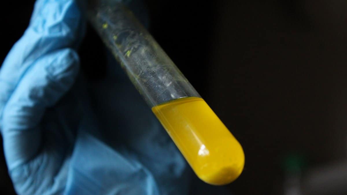 A gloved hand holds a test tube filled with yellow liquid, symbolizing scientific research.