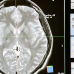 Intricate MRI brain scan displayed on a computer screen for medical analysis and diagnosis.