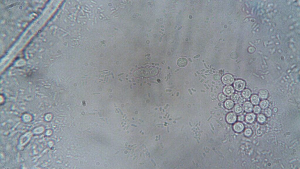 High-resolution microscope image showing various cellular structures and organisms.