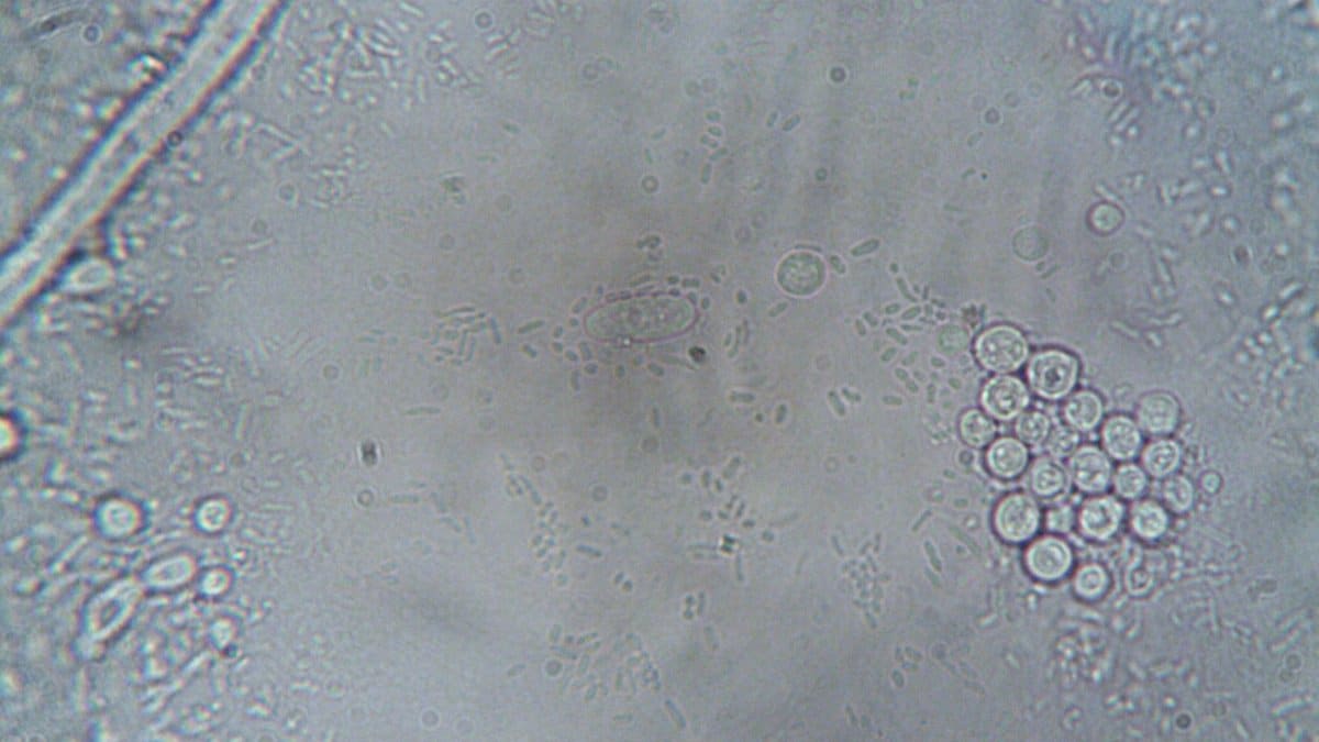 High-resolution microscope image showing various cellular structures and organisms.