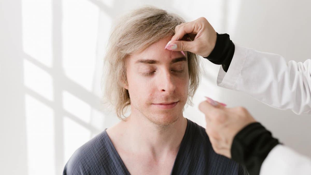 A man in a spa setting receiving acupuncture treatment for relaxation and holistic wellness.