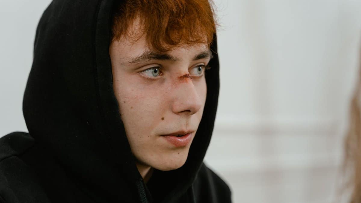 Teenager in a black hoodie looks away, revealing a fresh facial wound.