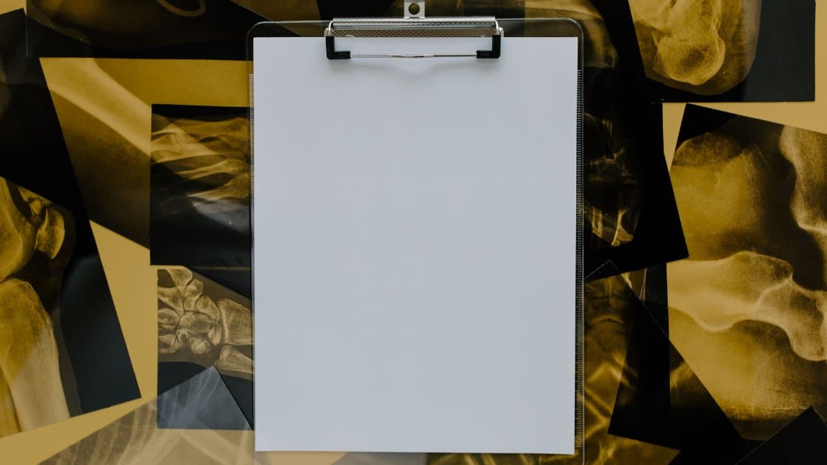 Top view of a blank clipboard on a background of various skeletal x-ray images, ideal for medical themes.