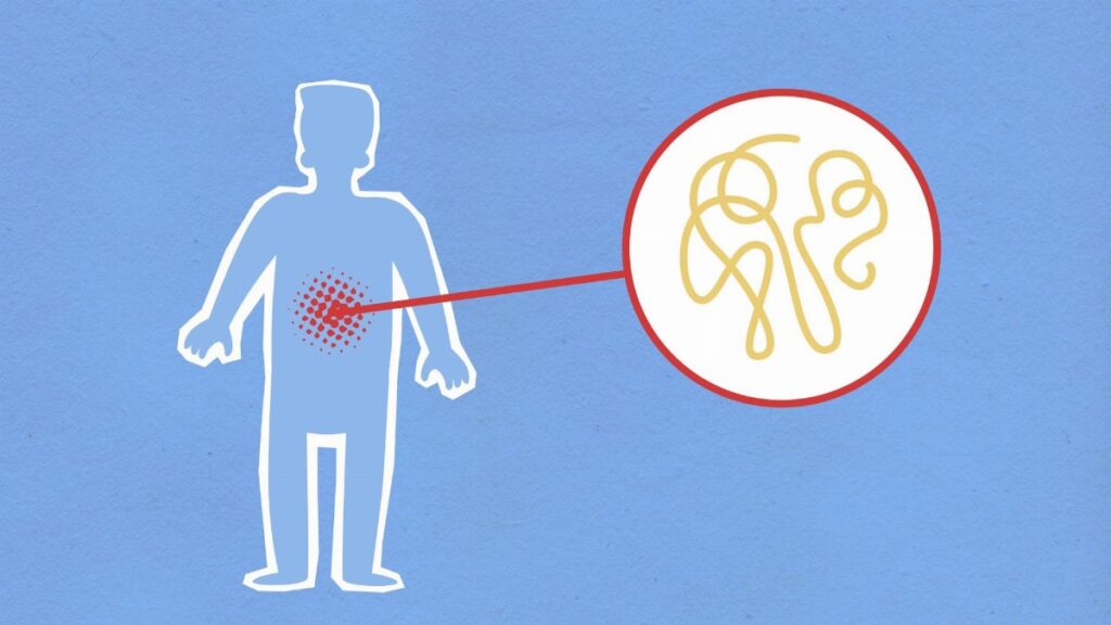 Cutout paper composition representing sick human figure with viral infection in stomach on blue background