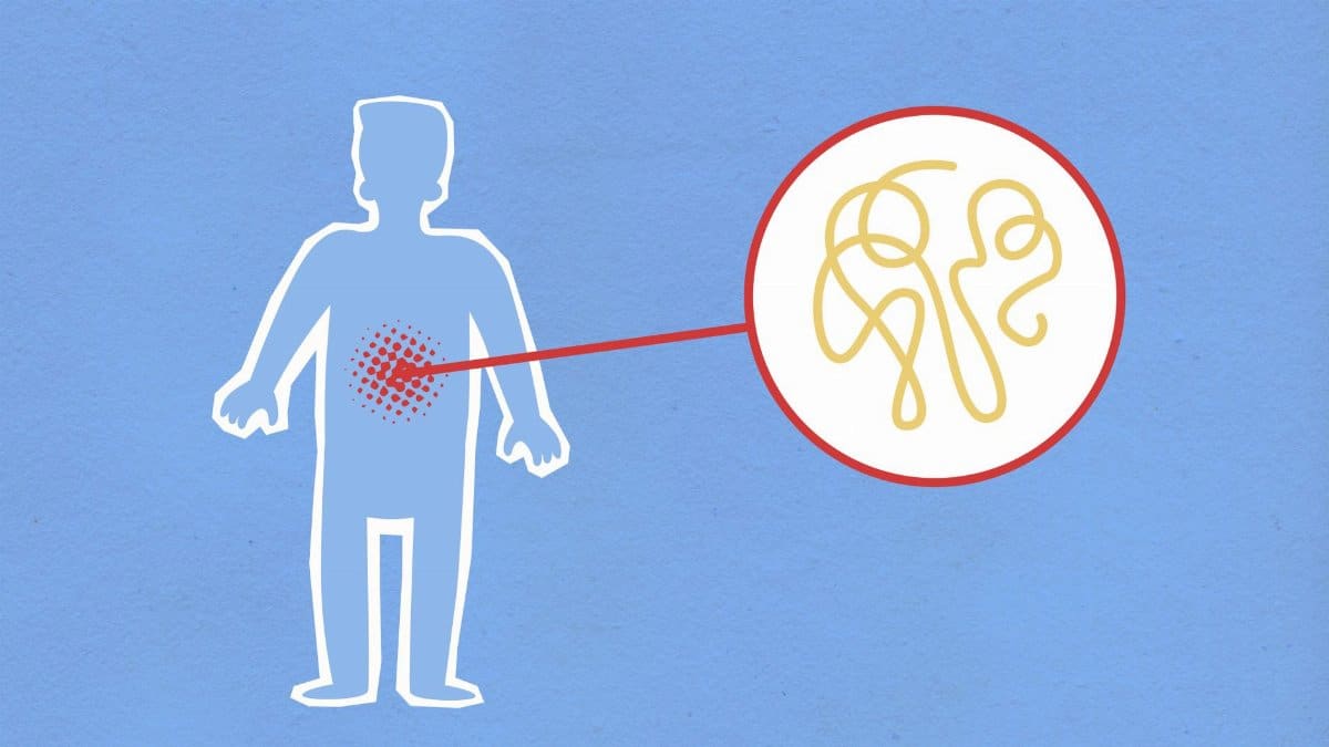 Cutout paper composition representing sick human figure with viral infection in stomach on blue background