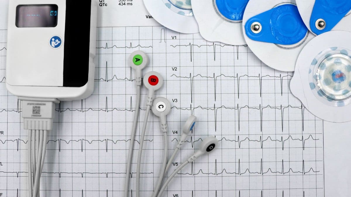 Close-up of ECG device with leads and electrodes on printed heart rate graph, showcasing medical technology.