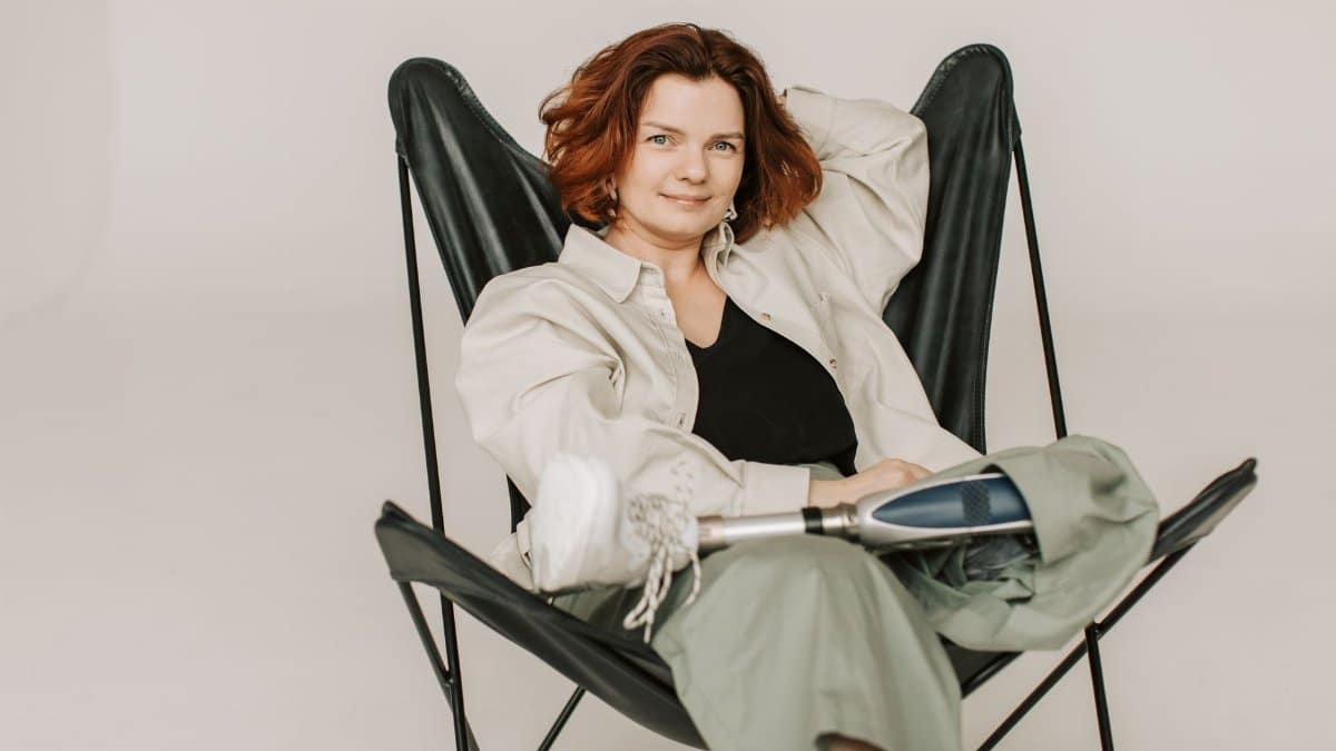Relaxed woman with prosthetic leg sitting confidently in a modern chair, smiling.
