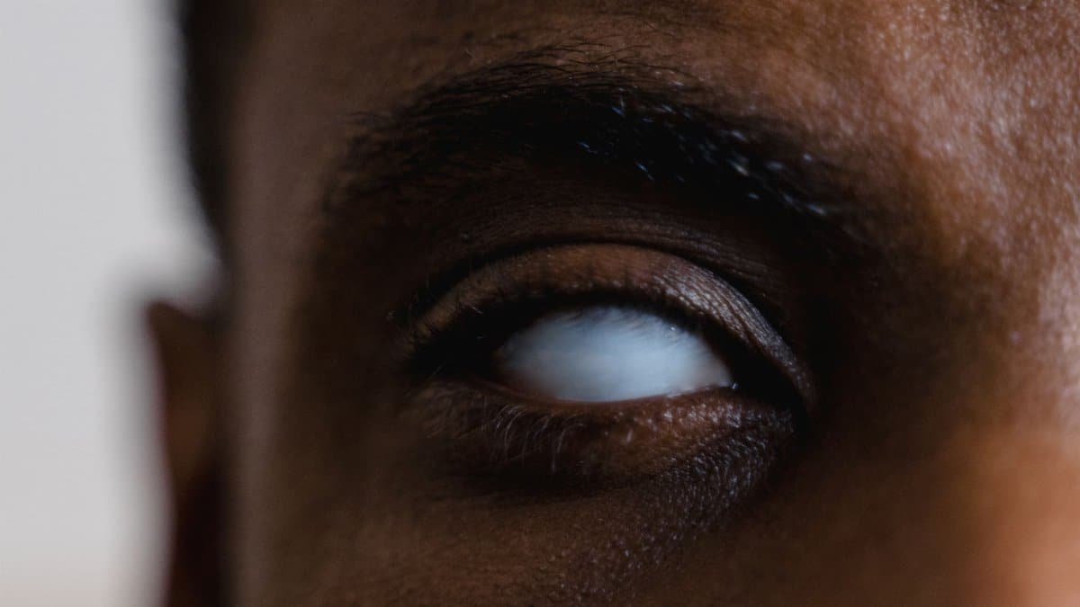 A detailed close-up photograph of an eye with a milky white appearance, representing blindness.