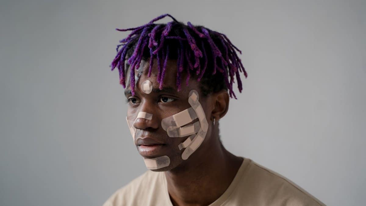 A person with dreadlocks and bandages on their face, reflecting a serious expression and unique style.